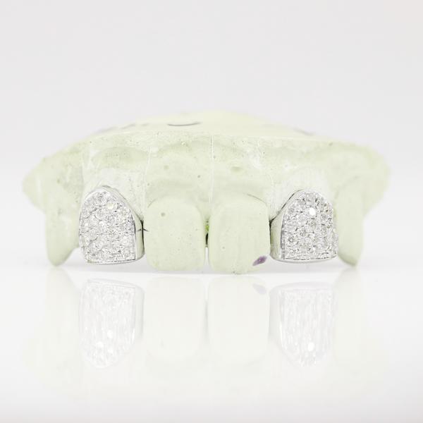 Two Tooth Diamond Grillz